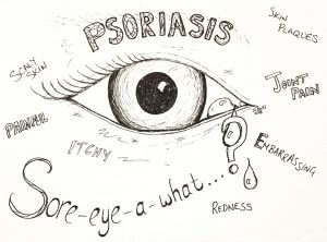 Psoriasis graphic