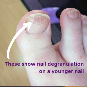 Potty Purple Pod and the Perils of the Pedicures – Potty Purple Pod